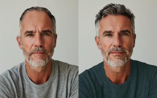 Can NMN Help Reverse Hair Thinning? The Emerging Science on NAD⁺, Hair Follicles & Longevity